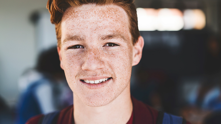 Boy with freckles